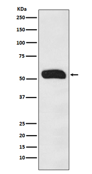 Human IgG Recombinant Rabbit Monoclonal Antibody