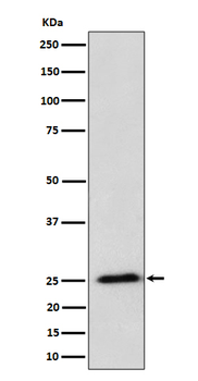 RPL10A Recombinant Rabbit Monoclonal Antibody