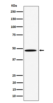 HIF Prolyl Hydroxylases Recombinant Rabbit Monoclonal Antibody