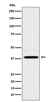 LTB4-R1 Recombinant Rabbit Monoclonal Antibody