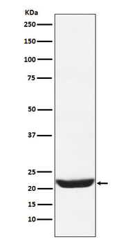 NCS1 Recombinant Rabbit Monoclonal Antibody