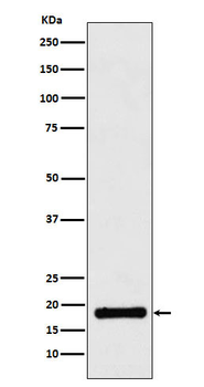 UBE2B Recombinant Rabbit Monoclonal Antibody