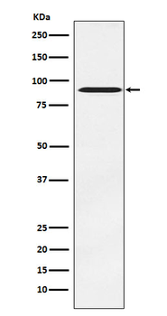 ATRIP Recombinant Rabbit Monoclonal Antibody