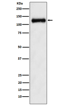 NPRB Recombinant Rabbit Monoclonal Antibody
