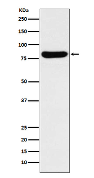 Beta glucuronidase Recombinant Rabbit Monoclonal Antibody