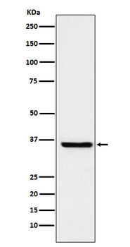 GSTO1 Recombinant Rabbit Monoclonal Antibody