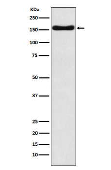 ATP7B Recombinant Rabbit Monoclonal Antibody