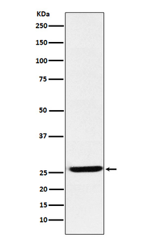 IL-27beta Recombinant Rabbit Monoclonal Antibody