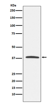KLRG1 Recombinant Rabbit Monoclonal Antibody