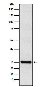 TPPP Recombinant Rabbit Monoclonal Antibody