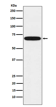 CYP1B1 Recombinant Rabbit Monoclonal Antibody
