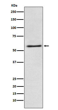 FAAH1 Recombinant Rabbit Monoclonal Antibody