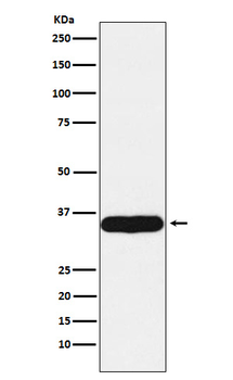 Tropomyosin Recombinant Rabbit Monoclonal Antibody