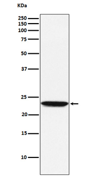 Tetranectin Recombinant Rabbit Monoclonal Antibody