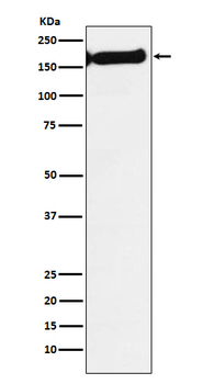 SF3B1 Recombinant Rabbit Monoclonal Antibody