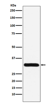 PSME1 Recombinant Rabbit Monoclonal Antibody