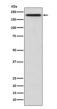 EIF2AK4/GCN2 Recombinant Rabbit Monoclonal Antibody