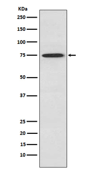 PKC theta Recombinant Rabbit Monoclonal Antibody