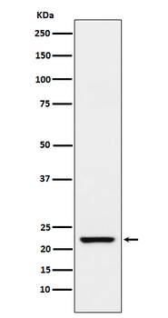 SM22 Alpha Recombinant Rabbit Monoclonal Antibody
