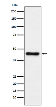 ABHD5 Recombinant Rabbit Monoclonal Antibody