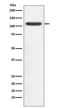 HIP1 Recombinant Rabbit Monoclonal Antibody