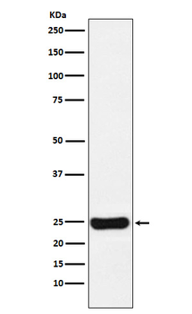 Cathepsin S Recombinant Rabbit Monoclonal Antibody