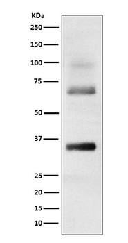 LOR/Loricrin Recombinant Rabbit Monoclonal Antibody