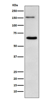 NUP153 Recombinant Rabbit Monoclonal Antibody