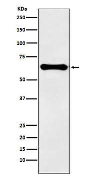 Factor IX Recombinant Rabbit Monoclonal Antibody