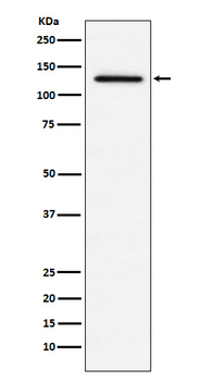 IFIH1 Recombinant Rabbit Monoclonal Antibody