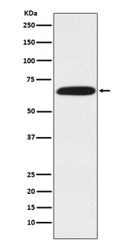 DDX5/p68 RNA Helicase Recombinant Rabbit Monoclonal Antibody