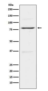 Insulin Receptor R Recombinant Rabbit Monoclonal Antibody