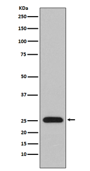 Human Ig lambda light chain Recombinant Rabbit Monoclonal Antibody
