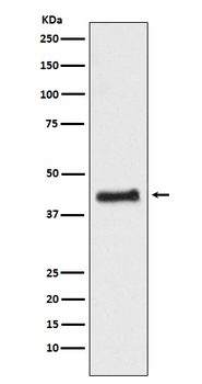 COUP-TF1 Recombinant Rabbit Monoclonal Antibody