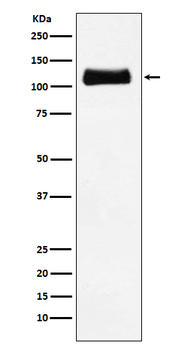 ApoER2 Recombinant Rabbit Monoclonal Antibody