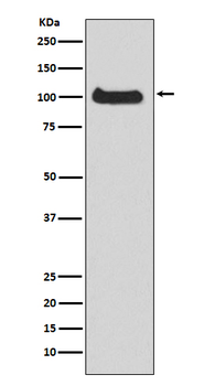PRKD1/PKC mu Recombinant Rabbit Monoclonal Antibody