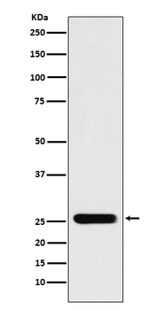 Peroxiredoxin 3 Recombinant Rabbit Monoclonal Antibody