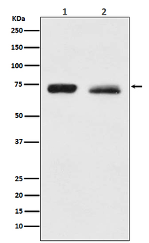 NF2 Recombinant Rabbit Monoclonal Antibody