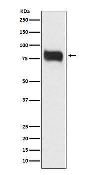 MBD1 Recombinant Rabbit Monoclonal Antibody