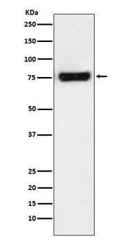 MTA2 Recombinant Rabbit Monoclonal Antibody