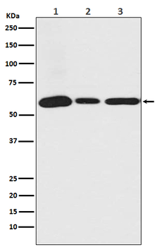 USP14 Recombinant Rabbit Monoclonal Antibody