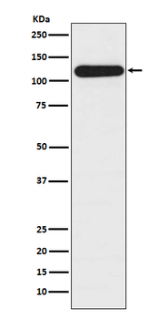 BubR1 Recombinant Rabbit Monoclonal Antibody