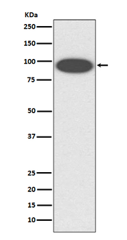 ITGB2 Recombinant Rabbit Monoclonal Antibody