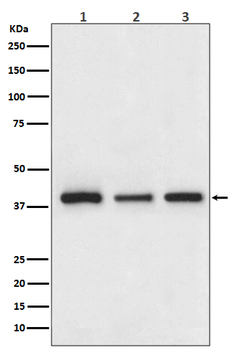 Cathepsin L/V/K/H Recombinant Rabbit Monoclonal Antibody