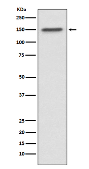 ASPP2 Recombinant Rabbit Monoclonal Antibody