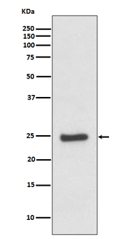 ZNRF2 Recombinant Rabbit Monoclonal Antibody