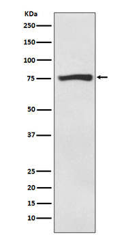 ACSS2 Recombinant Rabbit Monoclonal Antibody