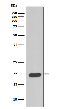 Caveolin 3 Recombinant Rabbit Monoclonal Antibody