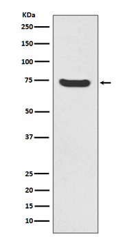 MAP3K2 Recombinant Rabbit Monoclonal Antibody