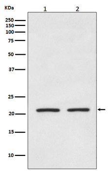 AKAP14 Recombinant Rabbit Monoclonal Antibody
